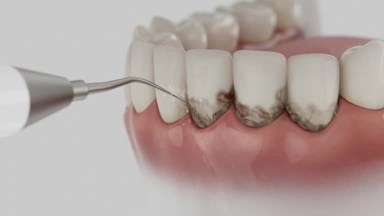 Reliable Teeth Cleaning And Checkup contractor in Evans County County, GA by Dentist Open Now